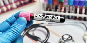 monkeypox vial